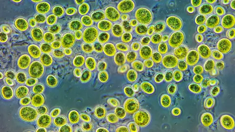 Mikroskopowe zdjęcie jednokomórkowych zielonych glonów z rodzaju Chlorella w kontraście fazowym, przy dużym powiększeniu.
