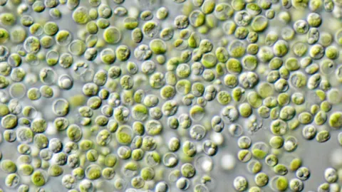 Komórki zielenicy Chlorella vulgaris pod mikroskopem świetlnym – drobne, kuliste, zielone komórki szczepu laboratoryjnego.