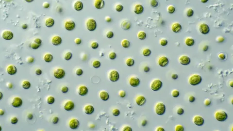 Mikroskopowe zdjęcie drobnych, kulistych komórek mikroglonów z rodzaju Nannochloropsis w hodowli laboratoryjnej.