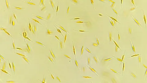Okrzemka Phaeodactylum tricornutum w hodowli laboratoryjnej pod mikroskopem – liczne wrzecionowate, żółtobrązowe komórki.